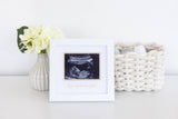 Love At First Sight Sonogram Picture Frame