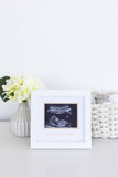 Love At First Sight Sonogram Picture Frame