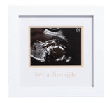 Love At First Sight Sonogram Picture Frame