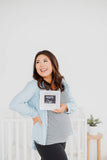 Love At First Sight Sonogram Picture Frame