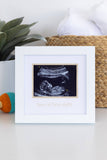 Love At First Sight Sonogram Picture Frame