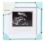 Love At First Sight Sonogram Picture Frame